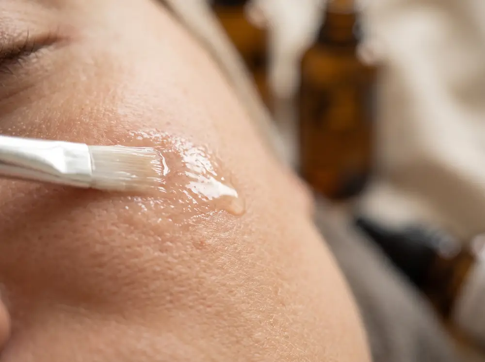 Pincel aplicando una capa fina de solución de peeling sobre la piel de la mejilla
