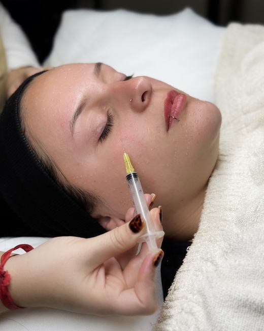 Sesión Dermapen / Meso